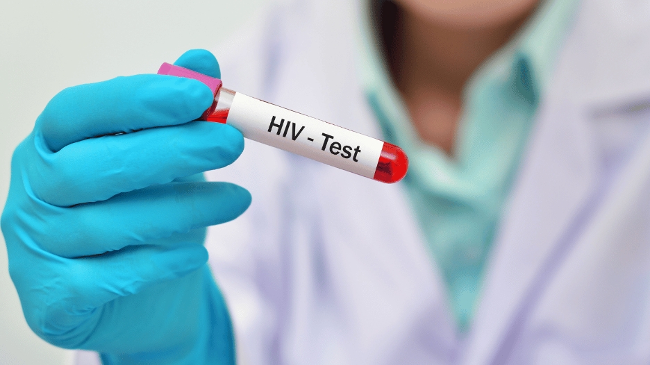 Early HIV Symptoms: What To Watch For And When To Get Tested