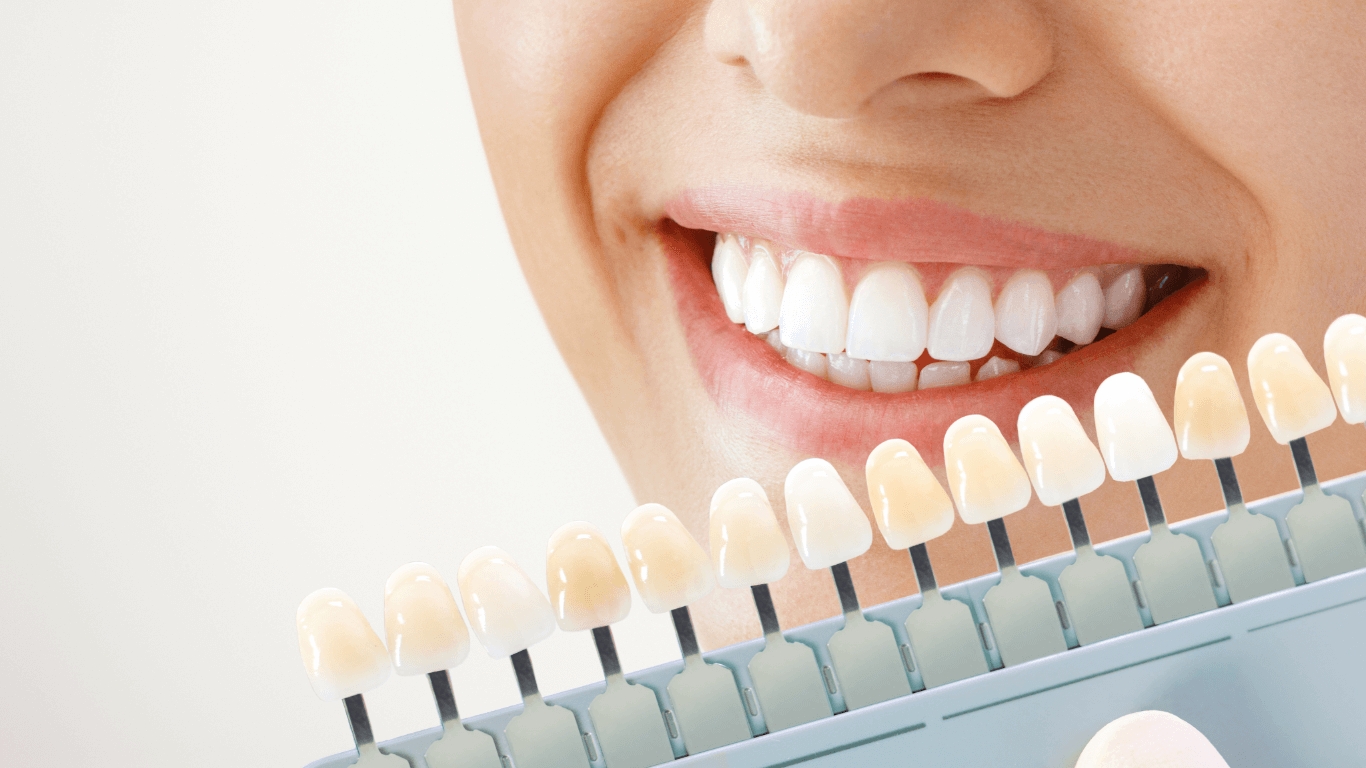 Brighten Your Smile: A Comprehensive Guide to Teeth Whitening