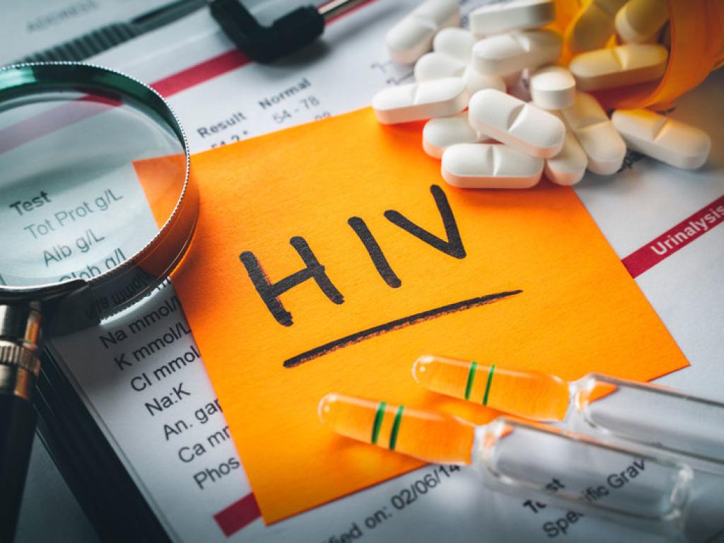 Understanding HIV: Key Facts and Modern Perspectives
