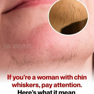 What your chin whiskers could tell you about your health… See more