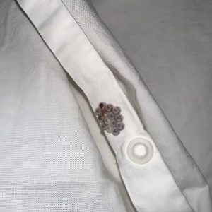 Those Tiny Balls in Your Bed? Here’s What They Really Are (And Why It’s Probably NOT Stink Bug Eggs)