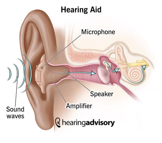 Embracing Clarity: The Importance and Benefits of Hearing Aids