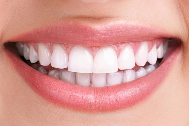 Choosing the Right Teeth Replacement Option: A Comprehensive Guide